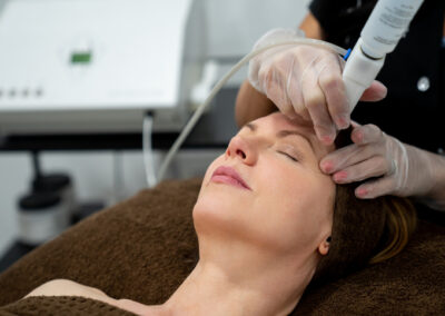 Microdermabrasion