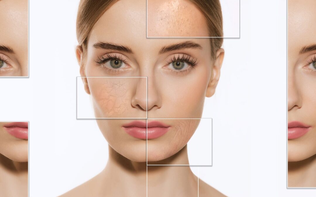 Essential Strategies for Marketing Yourself as a Certified Laser Hair Removal Technician